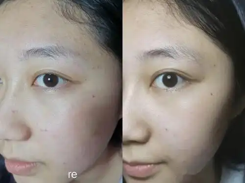 对比图高大胆过了26岁已经不能单纯做补水保湿,而正值初夏,永恒的美白