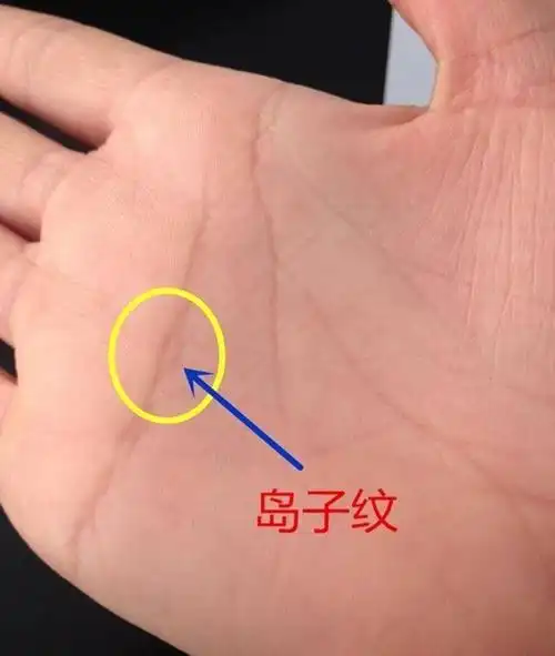 手相:"小岛"在哪安家,你哪里就衰得一塌糊涂,破坏之岛你有吗