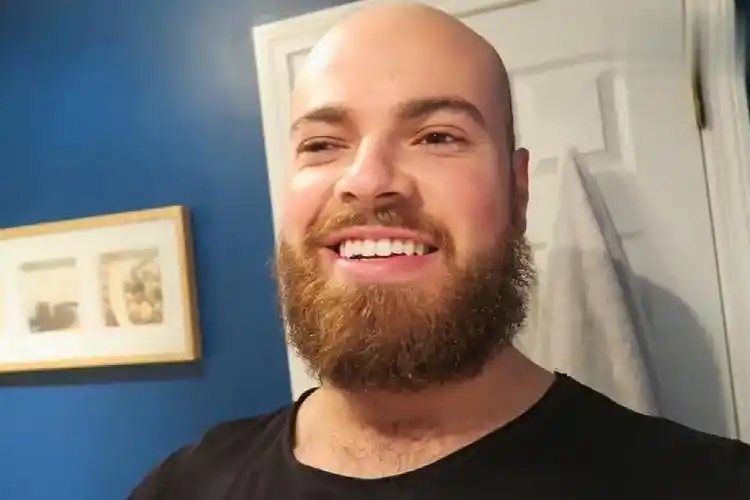 光头小哥满脸络腮胡看着好霸气,狠心刮掉后,变得清爽又可爱!