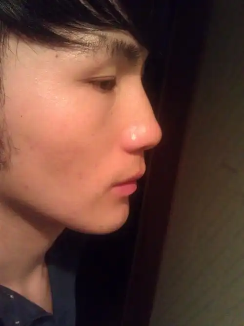 我的鼻子长的好不好算不算高鼻梁啊,,需要捏吗?