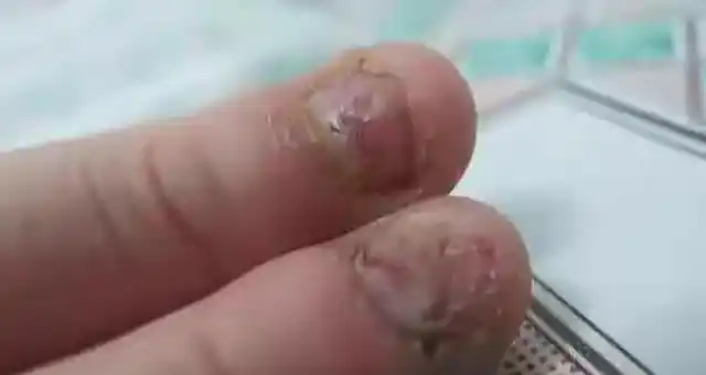 爱咬指甲,有很多危害,有很多细菌和病毒,易引起细菌性腹泻等疾病,还