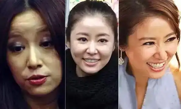 42岁林心如近照曝光妆前妆后判若两人网友素颜照太吓人