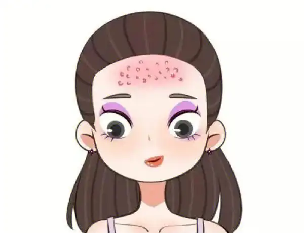 为什么额头总长闭口粉刺教你如何轻松解决