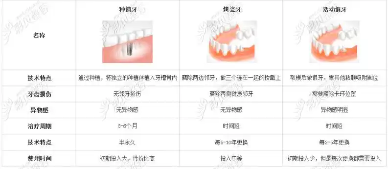 70岁老人全口假牙价目表带你了解老人装全口假牙多少钱