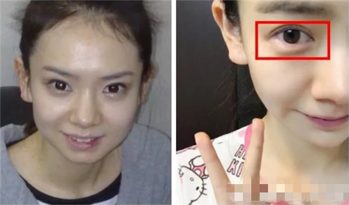 "割过双眼皮"的明星,陈学冬像是换了一个人,戚薇美出新高度!