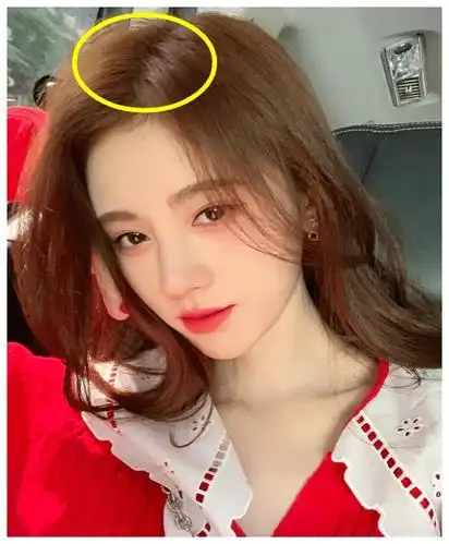 原来鞠婧祎发量多也不是天生的,当镜头拍到她的头皮,瞬间顿悟了