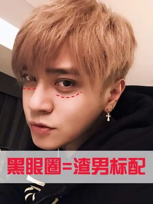 通过黑眼圈鉴渣男?罗志祥的黑眼圈到底是不是乱导致的