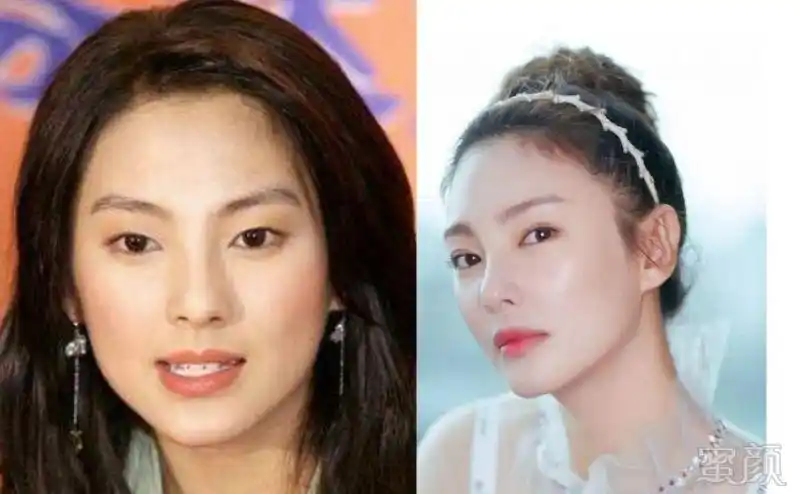 同样是整容,为什么钟楚曦,magbow整的比很多人高级呢?