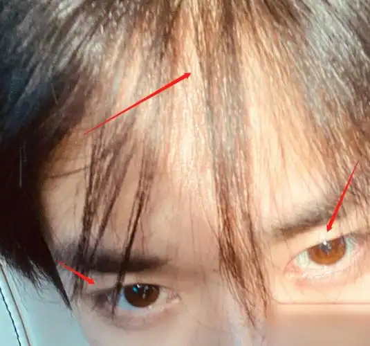 可以看到易烊千玺的发际线还是挺高的,但是总体看起来对他的颜值并没