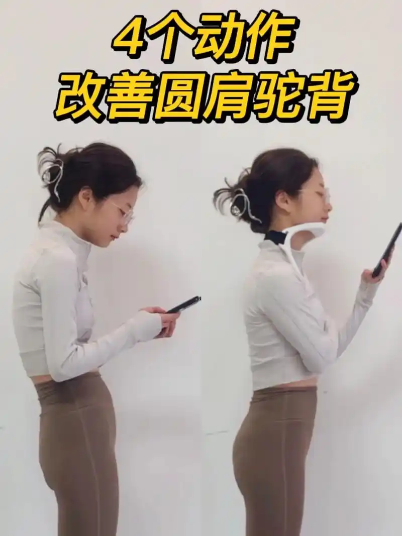 体态矫正天花板改善脖子前倾富贵包