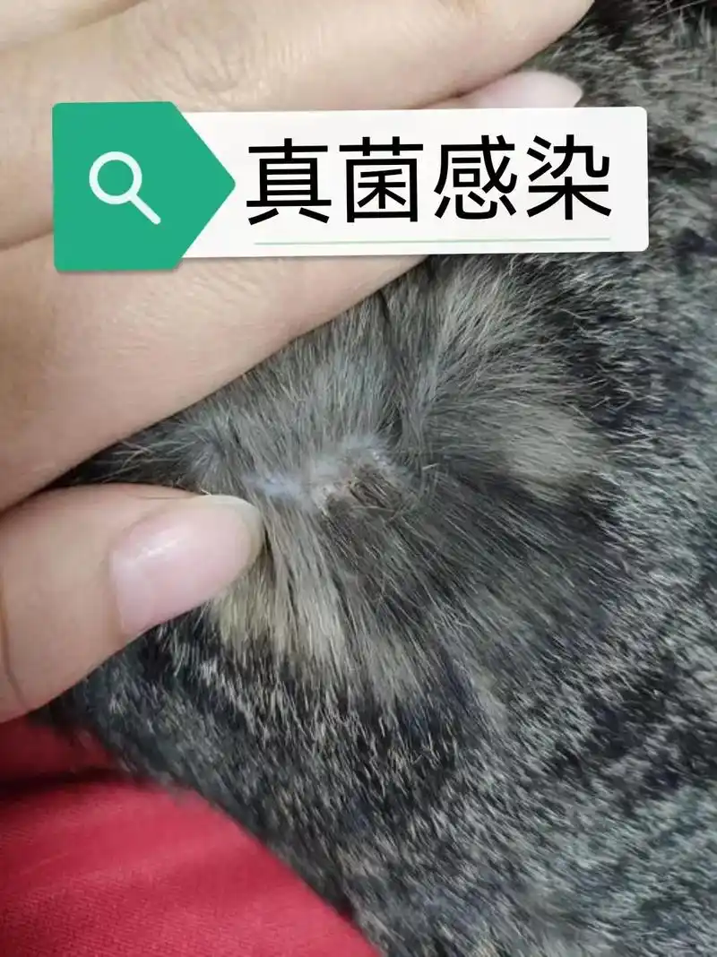 (教你判断各种皮肤病)1.真菌皮肤病(可传 - 抖音