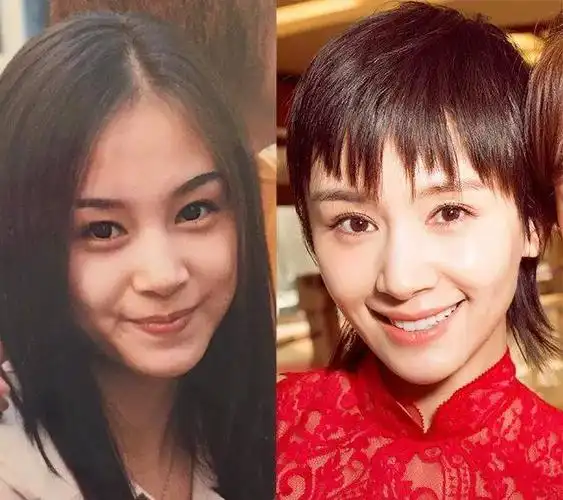 王子文16岁旧照让网友看出整形痕迹,她也做过和秦海璐一样的改变