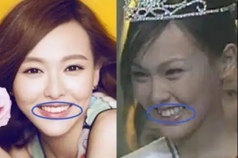 女星整牙前后对比:林心如整后笑容可人,唐嫣从"土妞"变女神