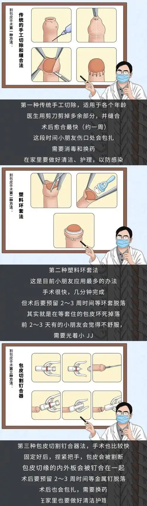 最后关于宝宝是否要割包皮给大家一份干货总结.1.