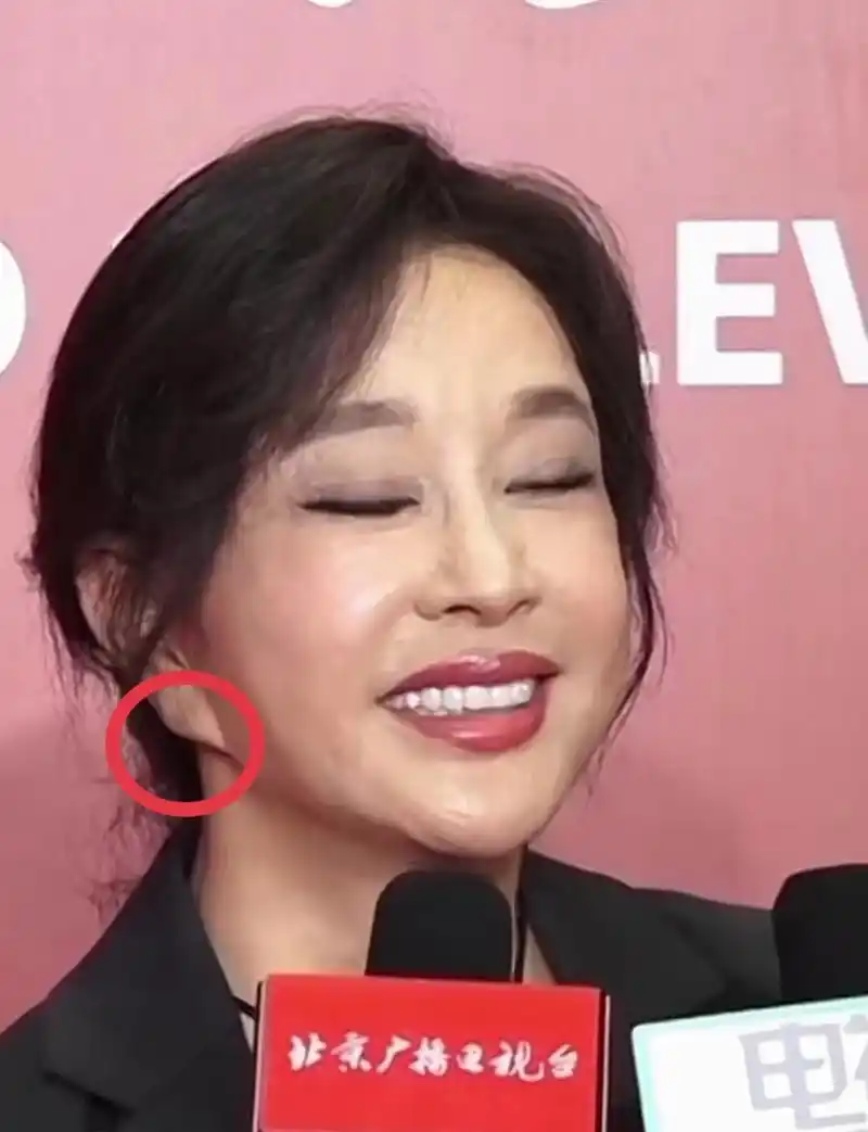 今天看到刘晓庆老师的采访视频,她的耳朵怎么长这个样子呢?