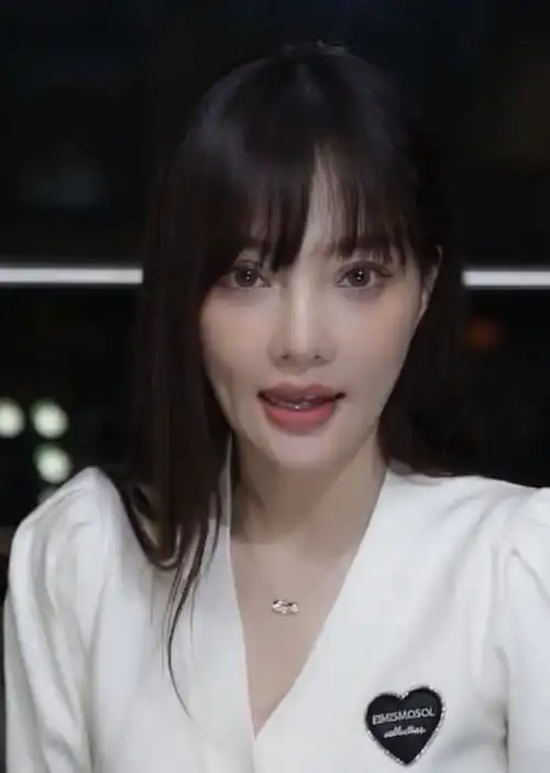 李小璐又重新做了欧式大双眼皮