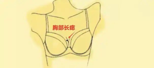 女孩胸前有痣图解女生胸前痣相解析