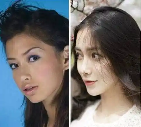 整容就要接受整容的后遗症,这东西迟早会来的,angelababy也躲不过这一