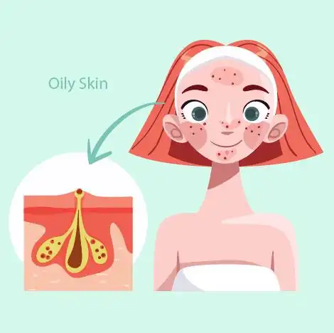 创意女子油性皮肤问题矢量素材时间:06-17手绘卡通女子油性皮肤问题