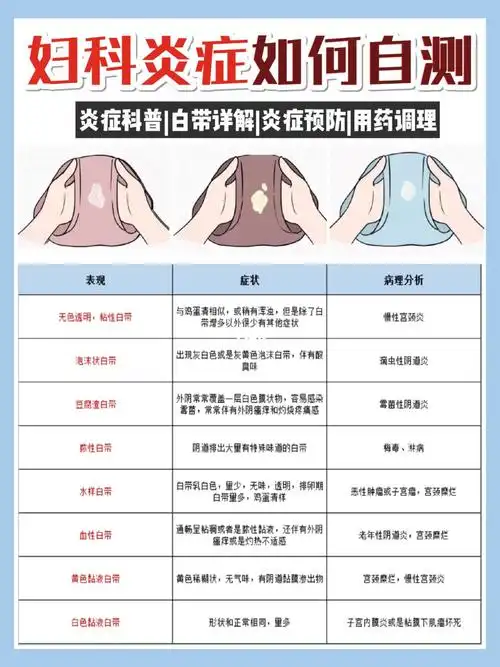 成年了女人必须知道的妇科小知识