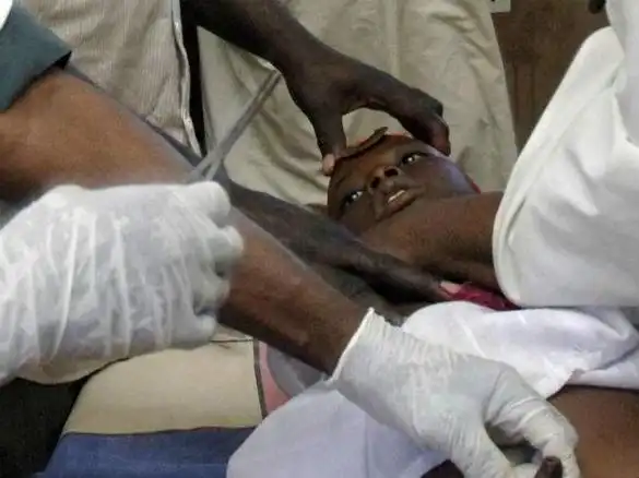 割礼是什么意思(割礼是什么意思图片 效果图)