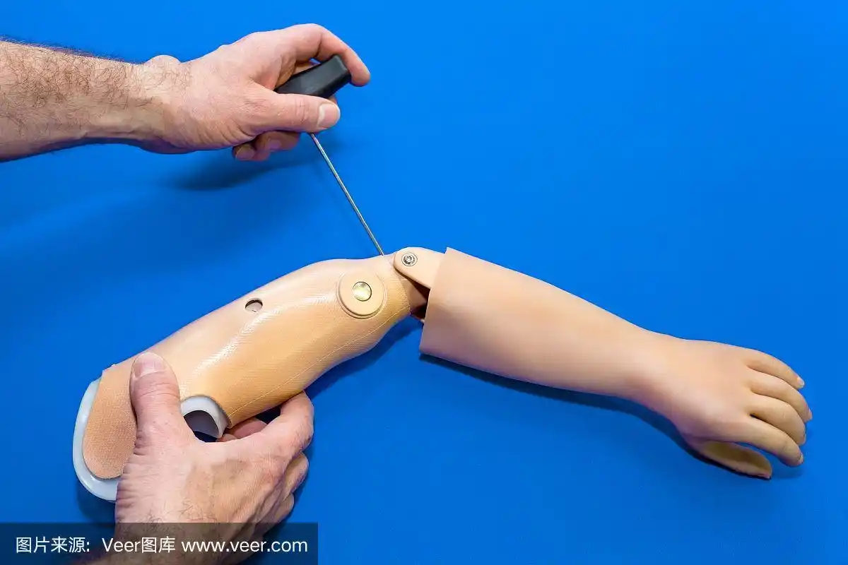 手在假肢上工作的观点.