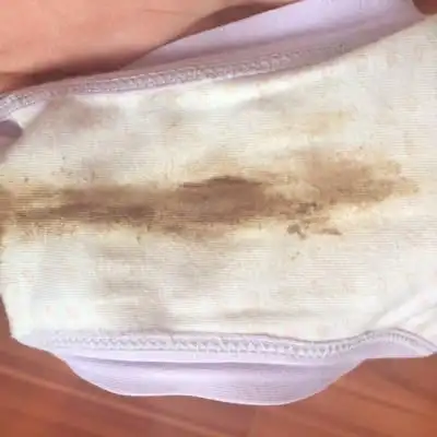 内裤出现这个为什麼