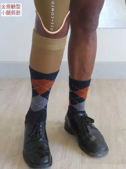 的小腿残端外形数据,在此基础上通过新的工艺制作完美贴合的接受腔