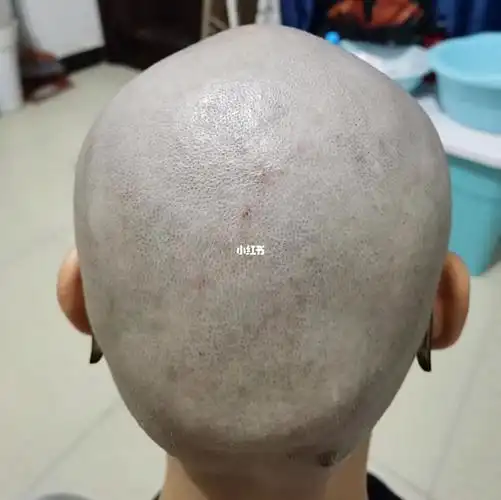 光头第13天 刮第6次_光头女生_时尚_发型