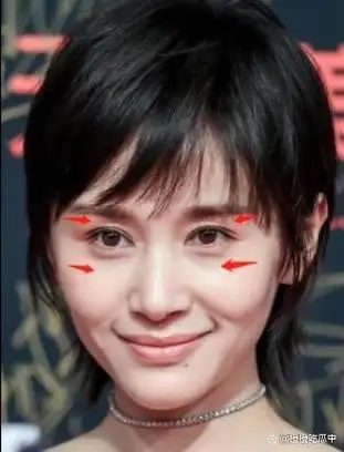 整容变美攻略:填充天花板王子文