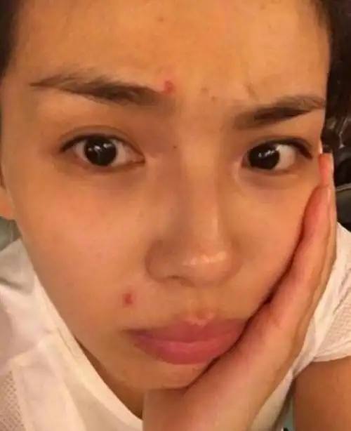 45岁瞿颖素颜照吓人满脸痘痘一黑毁所有姜文还会喊安红吗