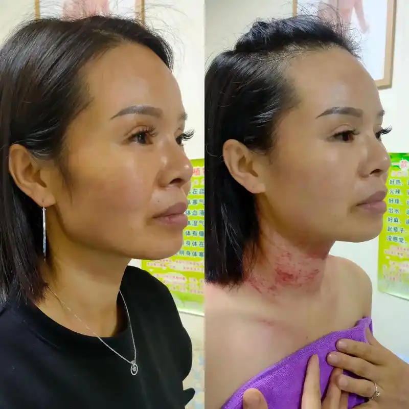 徒手整形一次年轻几岁,皮肤白了,法令文变浅,脸颊骨通过调整, - 抖音