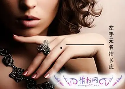左手无名指长痣有什么特殊含义