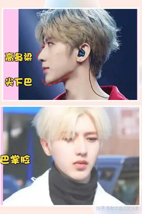 这张脸太假了蔡徐坤为什么总是被说整容