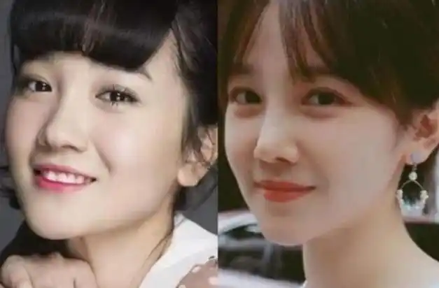 "整容最成功"的4位女星,最后一位明明动过刀,但却很自然!