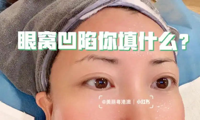 眼窝凹陷你会填什么