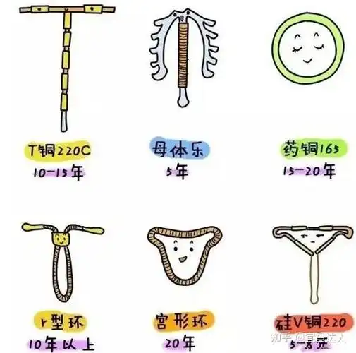 那些遗忘在体内的节育环该取出来了