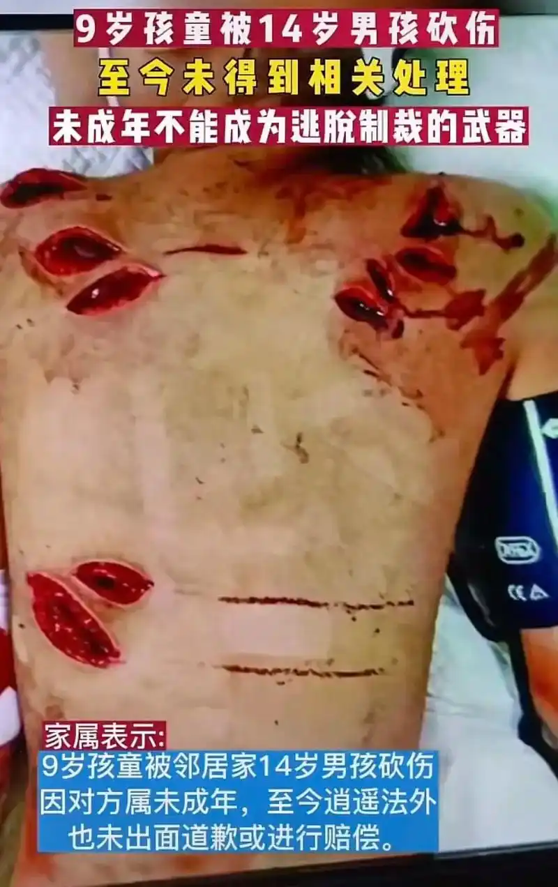14岁林姓男孩持刀砍伤9岁女童.#未成年人刑责降低至12岁  - 抖音