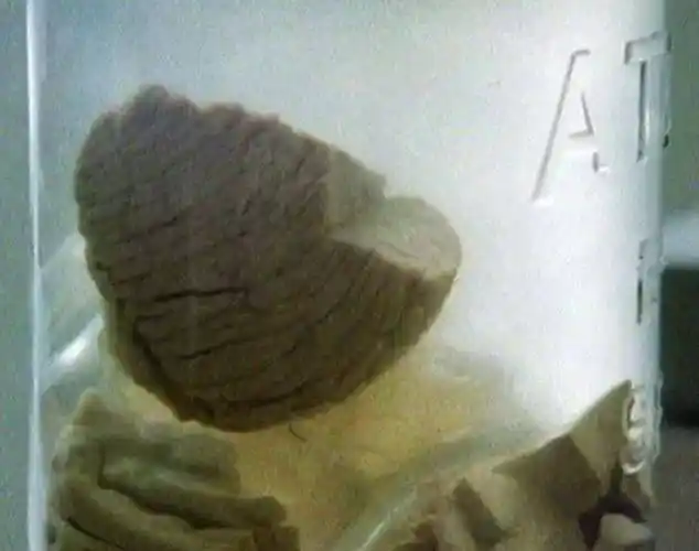 爱因斯坦去世后,大脑被分成240块切片,研究发现与常人不同