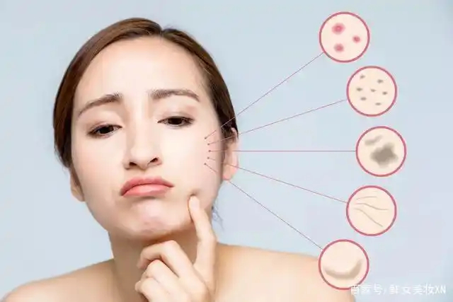 干燥,痘痘各种肌肤问题不断 就变得如此脆弱不堪 其实都是皮肤屏障惹