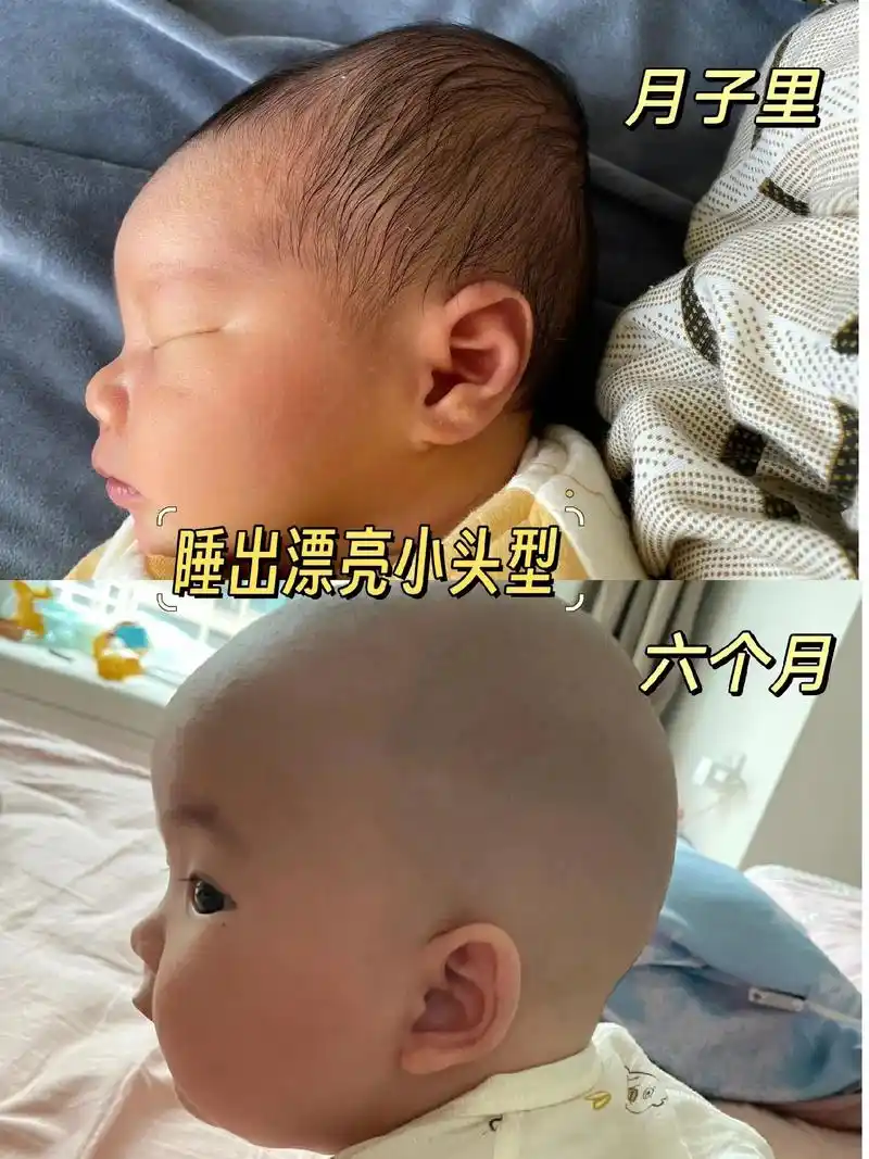 麻麻们,宝宝长时间歪头睡