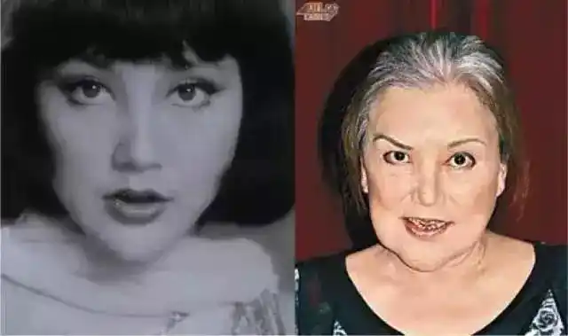 盘点娱乐圈那些整容失败的明星,个个都让人不忍直视!