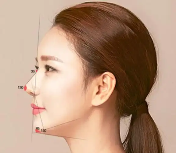 "鼻部软骨支架重建"理念,再结合黄金比例分割作为面部美学参考标准,从