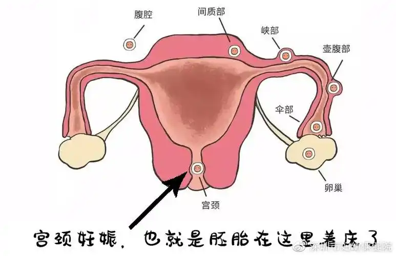 还没成型的娃居然在子宫里滑滑梯