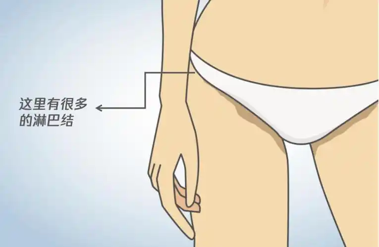 腹股沟附近分布着很多大血管,而淋巴结大多沿着血管排列,所以腹股沟处