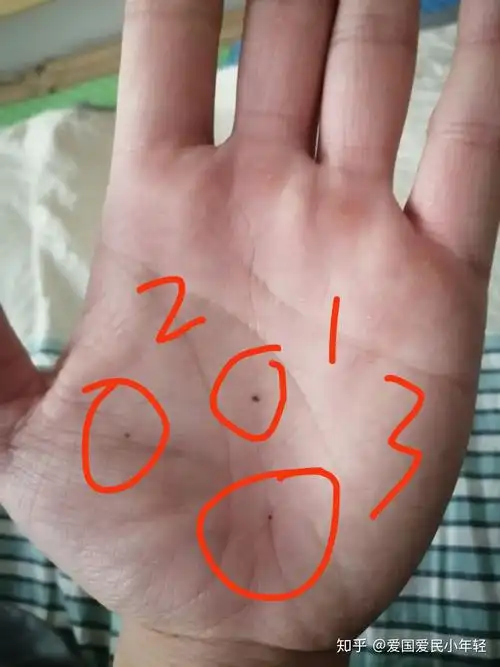 掌心有痣是什么体验