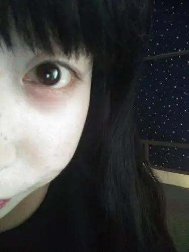 请问这是怎么了下眼皮肿了有点痒