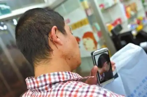 原告头部被打流血. 文内图片均来自京华时报