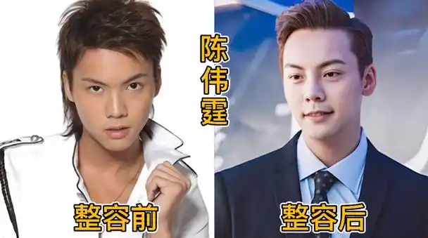 众所周知,娱乐圈的明星们特别热爱整容,尤其是女明星,几乎每隔一段