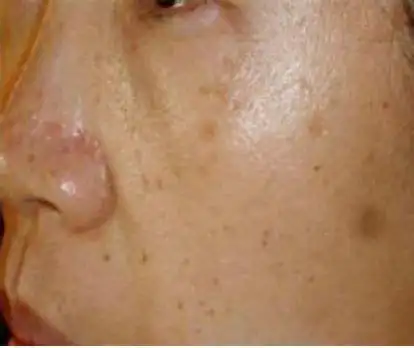 皮肤暗沉发黄,无光泽,怎么破? - 知乎